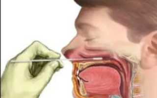 Взятие мазка из носоглотки на менингококк алгоритм