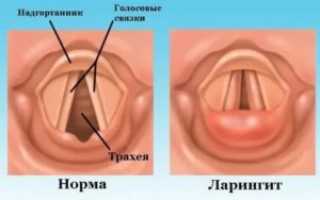 Врач который лечит голосовые связки как называется