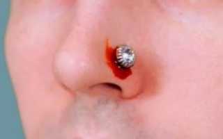 Через сколько зарастает дырка в носу