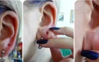 Воспаление мочки уха в месте прокола