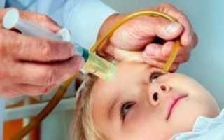 Санация носа в домашних условиях