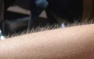 Мурашки по лицу и голове причины