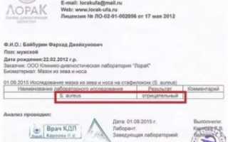 Анализ на дифтерию как сдавать