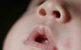 Ребенок постоянно шмыгает носом но соплей нет