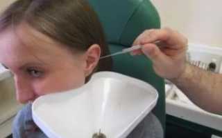 Потрескивание в ухе что это