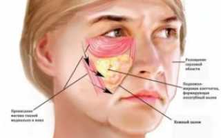 Болит скула на лице при нажатии
