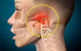 Почему болит скула с правой стороны