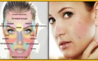 Почему болят скулы на лице