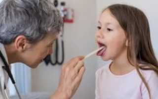 Частые ангины у ребенка причины