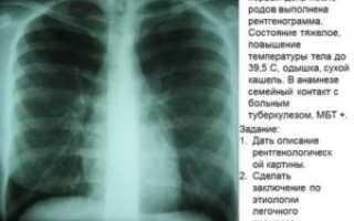 Рентген снимки легких с описанием