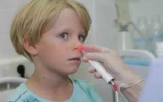 Аллергический аденоидит у детей симптомы