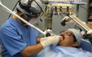 Удаление гланд лазером видео