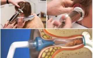 Как удалить серную пробку у ребенка