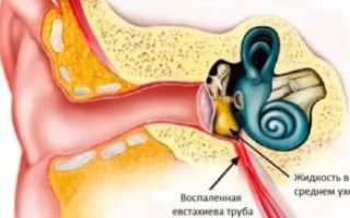 Почему булькает в ухе
