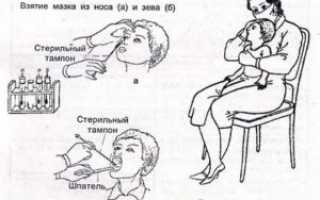 Забор мазка из зева и носа