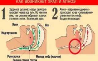 Задержка дыхания во сне у взрослых причины