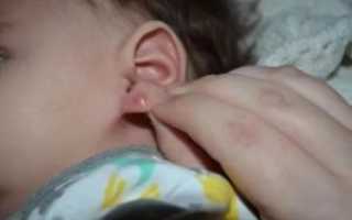 Почему болит мочка уха