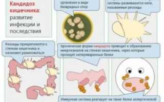 Грибок в крови симптомы лечение