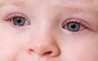 Конъюнктивит и температура у ребенка