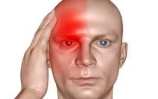 Тяжесть во лбу