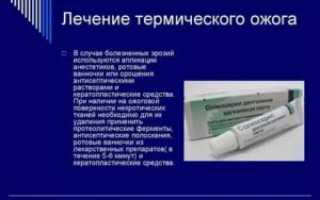 Ожог неба лечение в домашних условиях