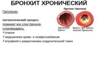 Грибок в бронхах симптомы и лечение