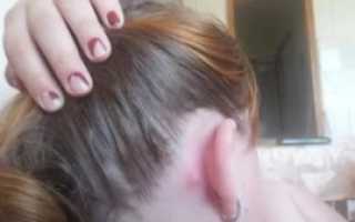 Шарик за ухом болит