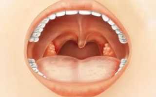 Стоматит на гландах лечение