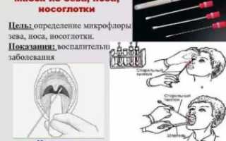 Мазок из зева как подготовиться