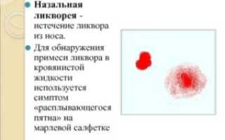 Мозговая жидкость течет из носа