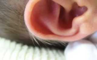 Запах из уха у ребенка причины