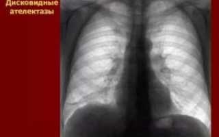 Плевральные спайки в легких что это