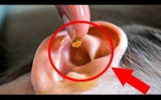 Черная сера в ушах у человека