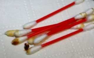 Сера в ушах коричневого цвета