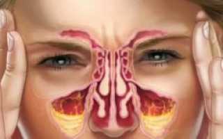 Заложенность одной ноздри