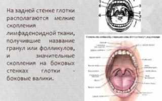 Зернистость задней стенки глотки