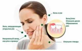 Болит ухо после лечения зуба