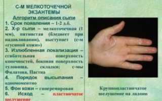 Передается ли скарлатина от детей к взрослым