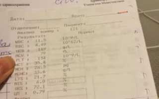 Анализы при ангине у взрослых