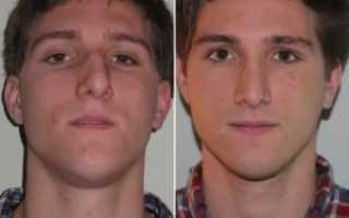 Как выровнять нос в домашних условиях