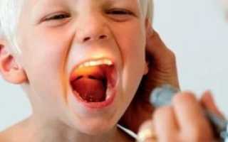 Что значит рыхлое горло у ребенка
