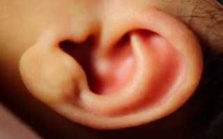 Волосатые уши у новорожденного