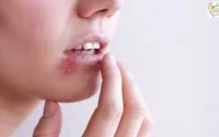 Почему чешется небо во рту причины