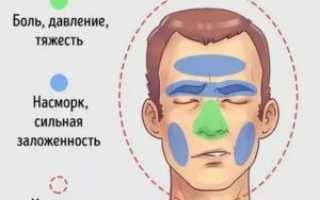 Боль в области переносицы и лба