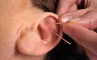 Болячка в ухе чем лечить