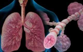 Отек бронхов симптомы и лечение