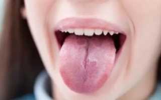 У ребенка обложен язык белым налетом