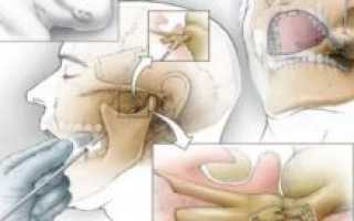 Болит ухо и зуб одновременно что делать
