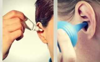 Закапала ухо и его заложило