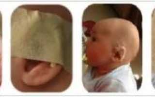 Разные уши у новорожденного